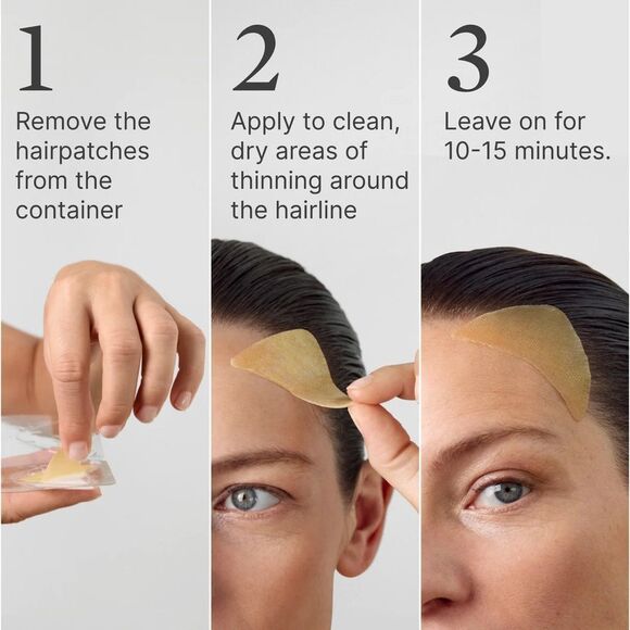 Superpower Thickening Hairpatches - Gold - Picture 6 of 10